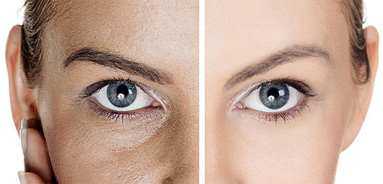 KORE CİLT BAKIM - Göz çevresindeki kırışıklık & koyu halkaları gidermek için ne yapmalı